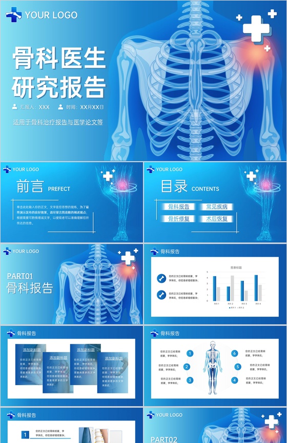 蓝色简洁骨科医生治疗研究报告医学论文答辩PPT模板